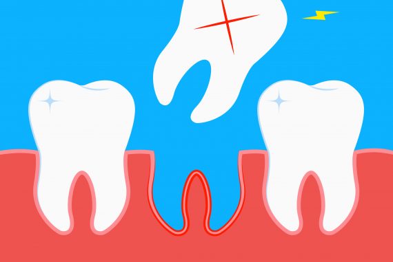 Cognitive decline and dementia due to tooth loss - treatment exercises